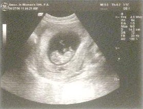 Babyat10weeks Babyat10weeks